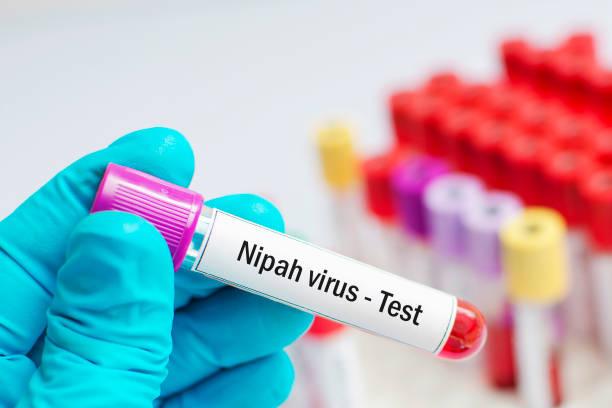 Virus Nipah : faut-il s’inquiéter au Maroc ?