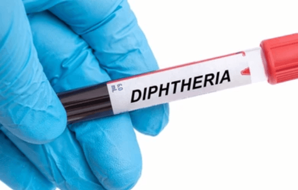 Diphtérie : 30 cas confirmés et deux décès au Maroc
