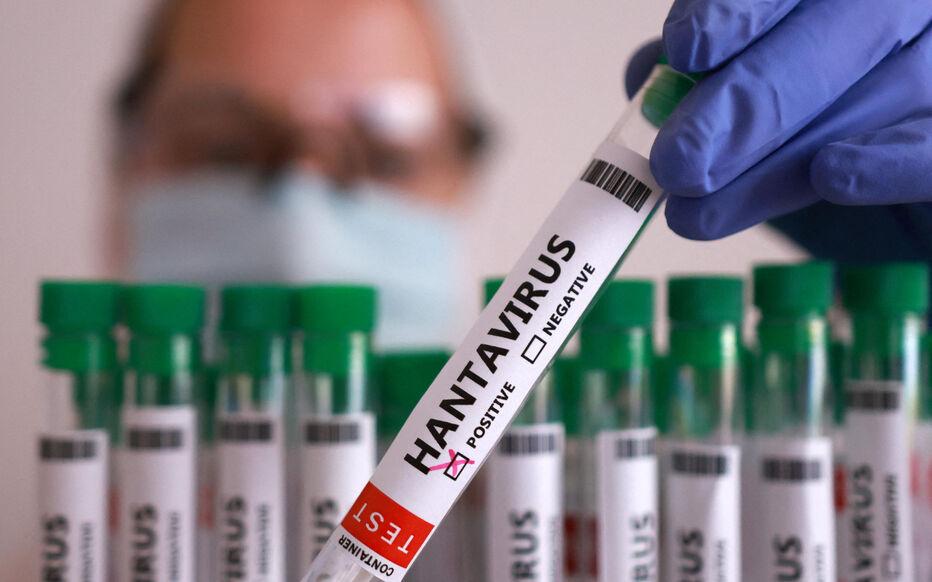 Hantavirus : faut-il s’inquiéter au Maroc ? Le ministère de la Santé répond