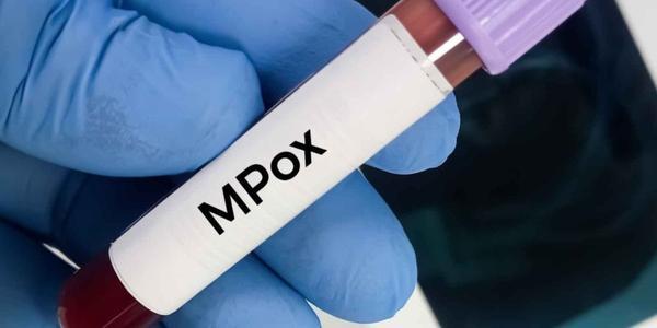 Mpox : un test PCR marocain prêt à protéger toute l’Afrique