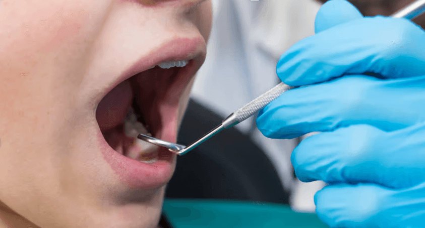 Faux dentistes, vrais risques : les médecins dénoncent une dérive