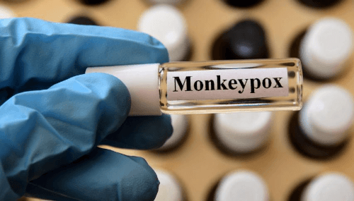 Le Japon signale un premier cas de variole du singe