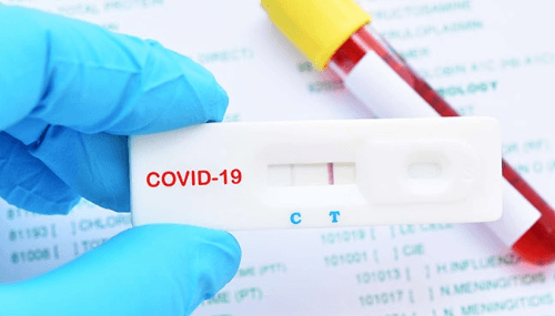 Bilan hebdomadaire Covid-19 : 254 nouvelles infections signalées, aucun décès