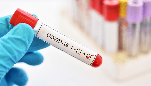 Covid-19 au Maroc : Baisse des nouvelles infections, aucun décès en semaine
