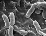Une bactérie causant une grave maladie infectieuse détectée aux États-Unis